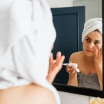 Mélasma : pourquoi il revient et comment limiter la récidive