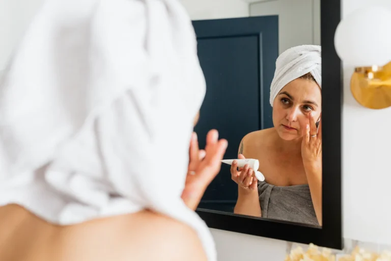Mélasma : pourquoi il revient et comment limiter la récidive